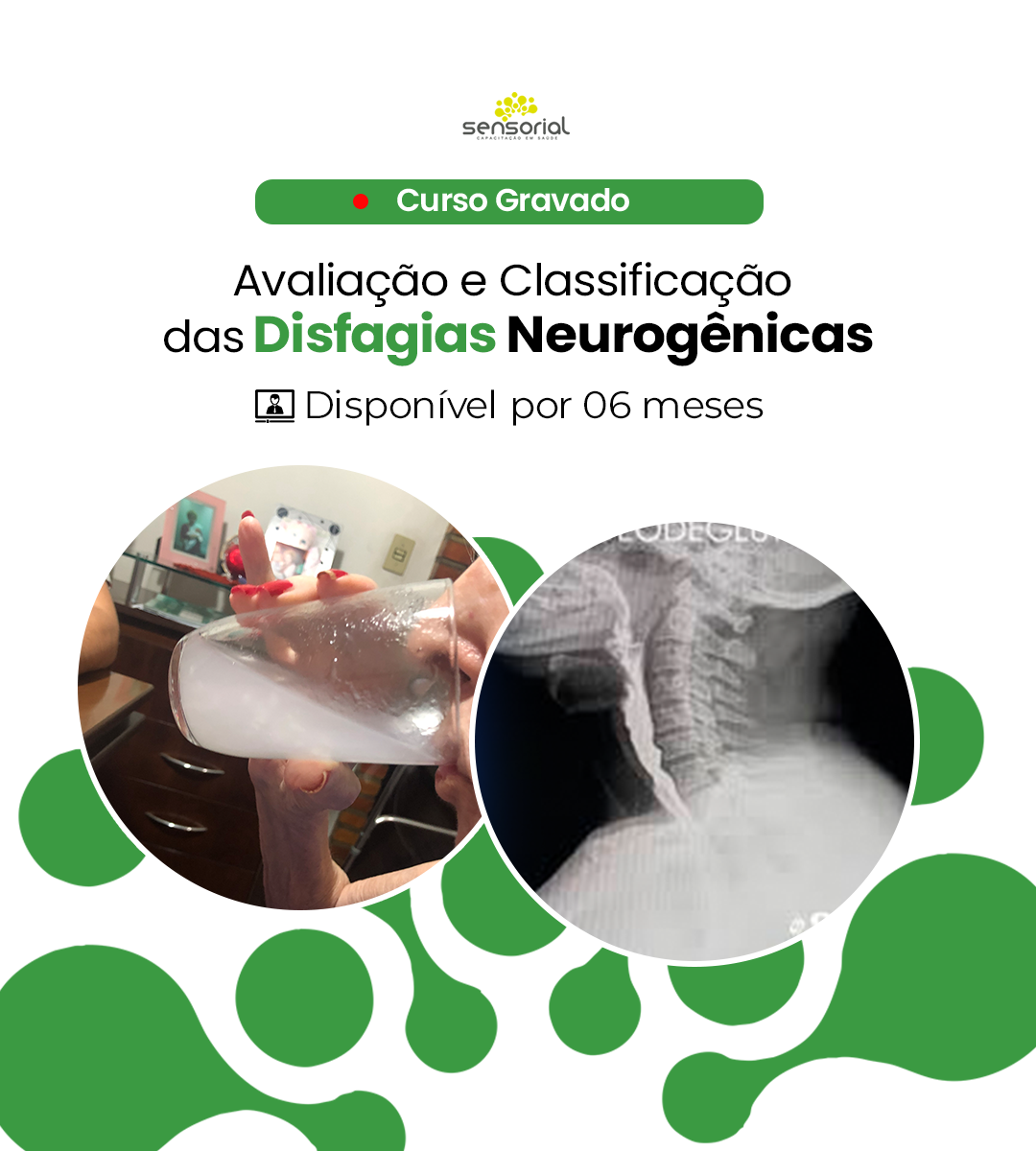 Avaliacao-Disfagia.png